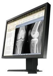 EIZO RadiForce MX210 Black 21,3˝