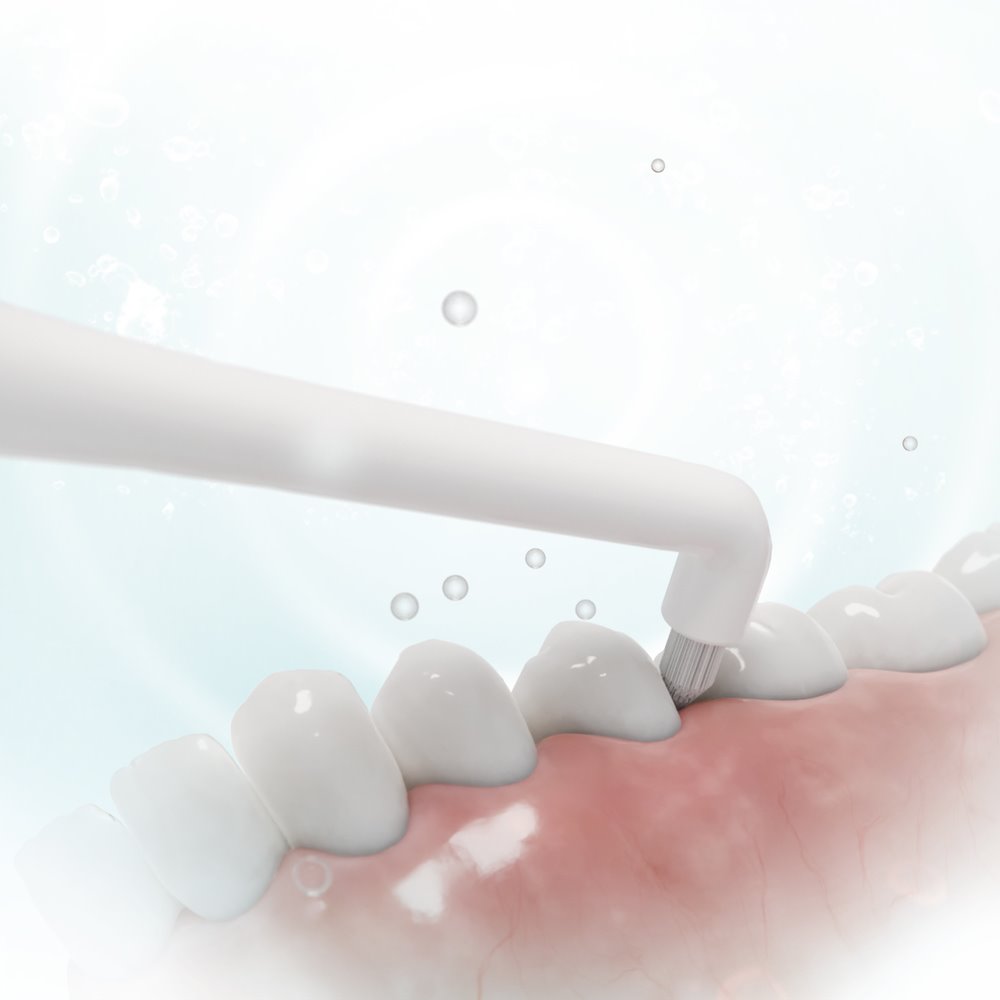 Sencor SOX 107 Náhradní hlavice Interdental pro SOC 4210BL/4211GD, 2 ks